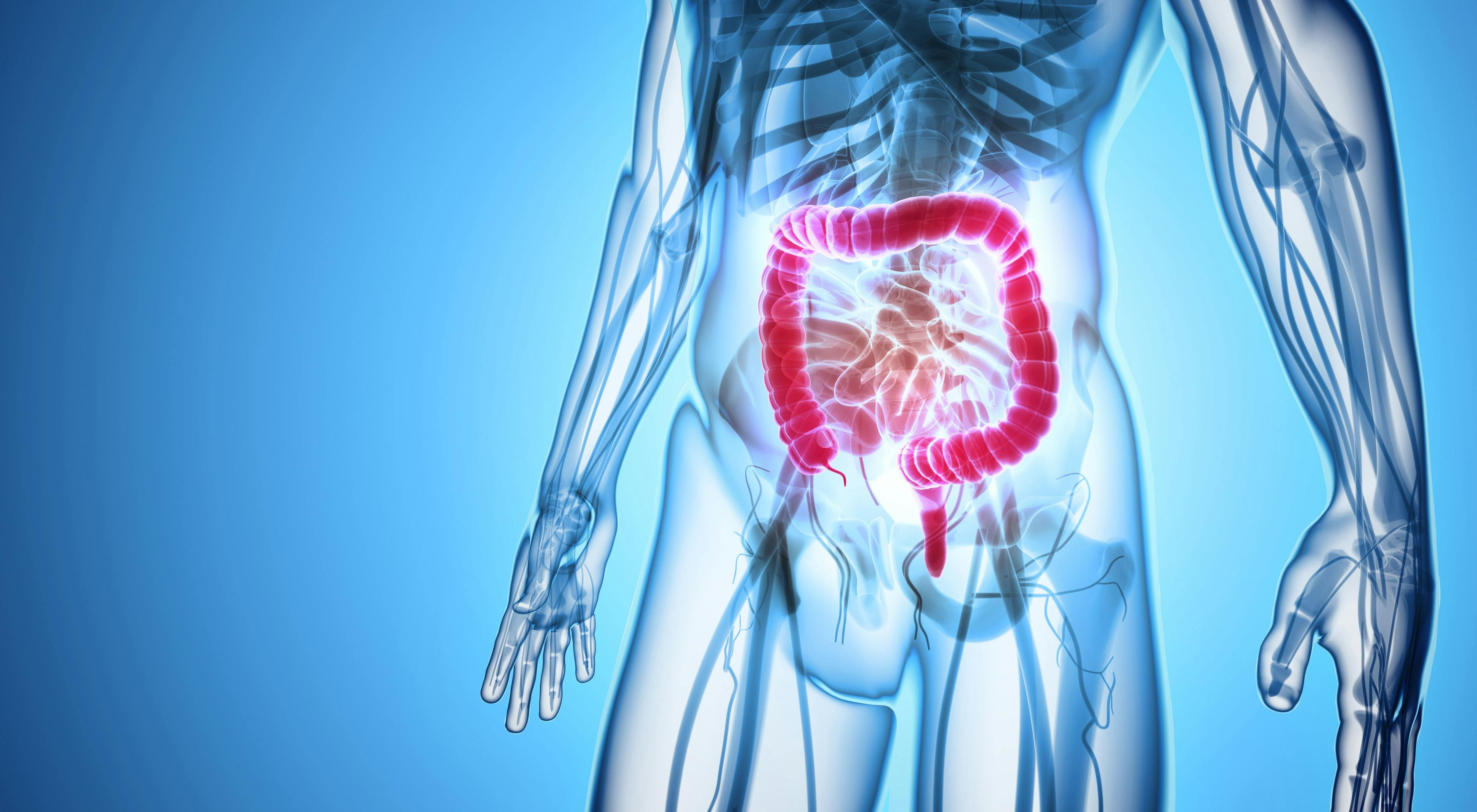 Metastatic Colorectal Cancer Treatments Continue to Change
