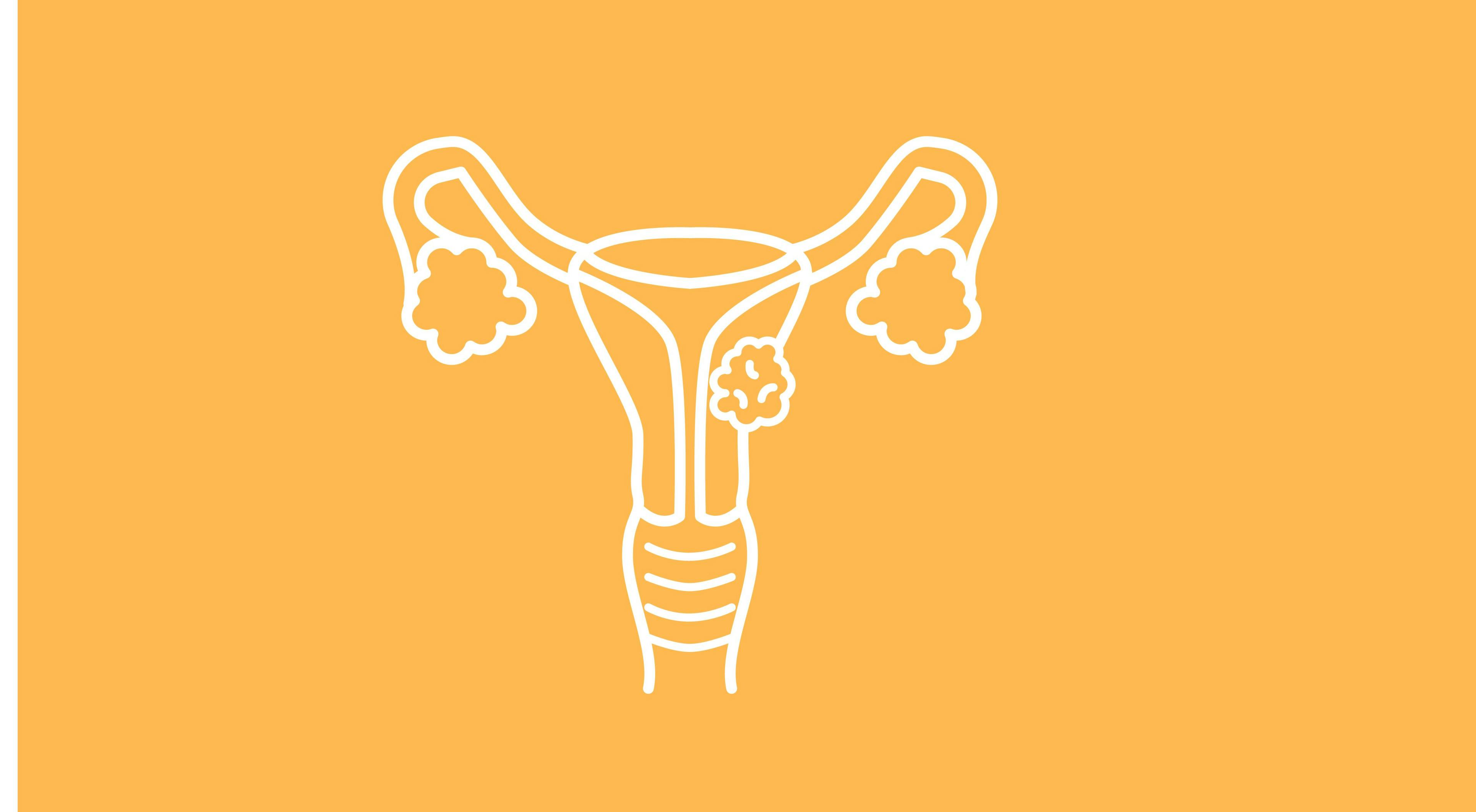 Updated Cervical Cancer Screening Guidelines