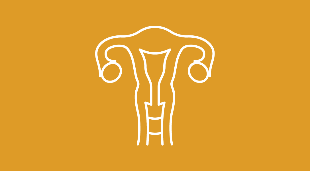 Estrogen Therapy May Impact Ovarian/Endometrial Cancer Incidence in Postmenopausal Women After Hysterectomy