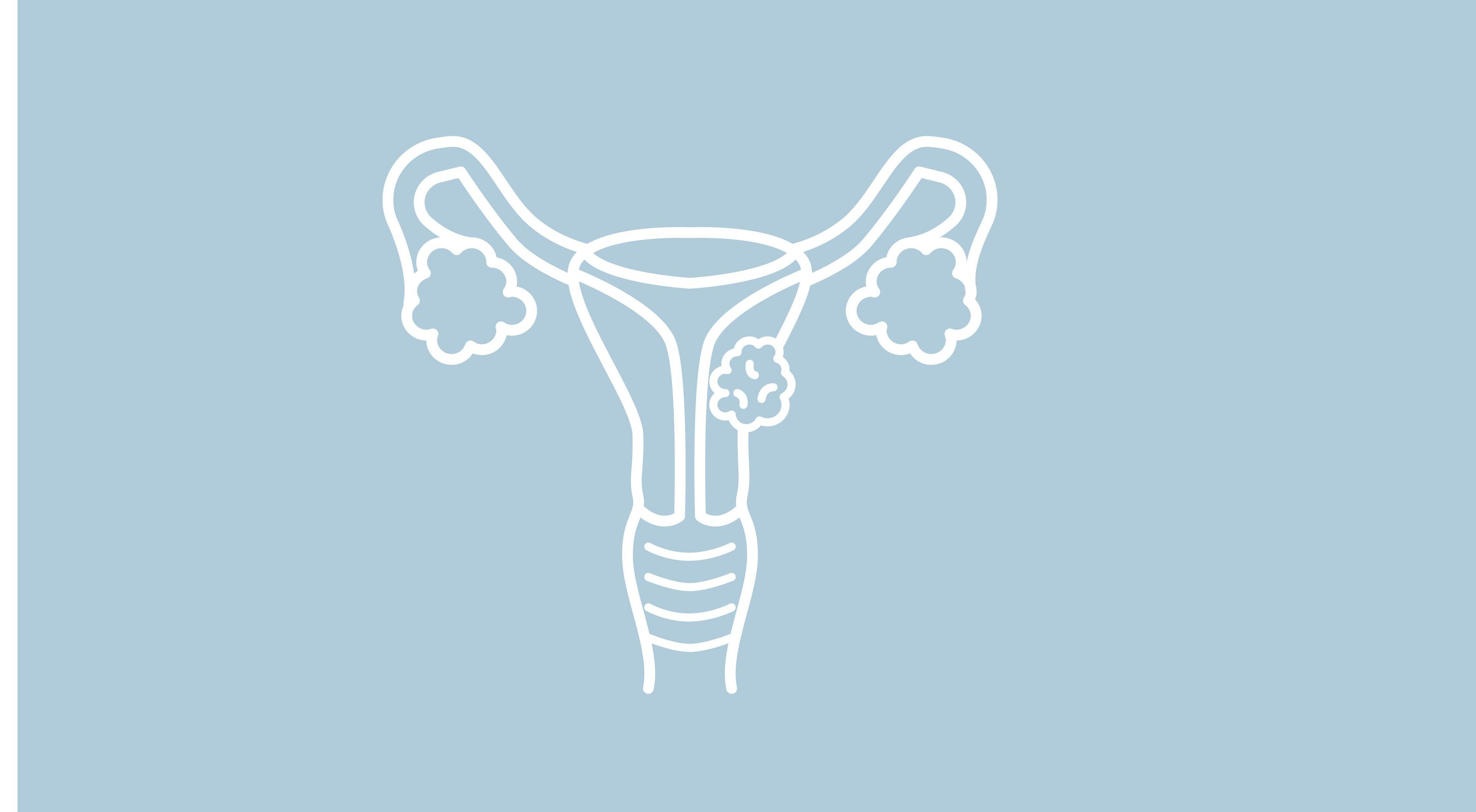 Early Surgery in Endometrial Cancer Linked to Worse Survival Outcomes