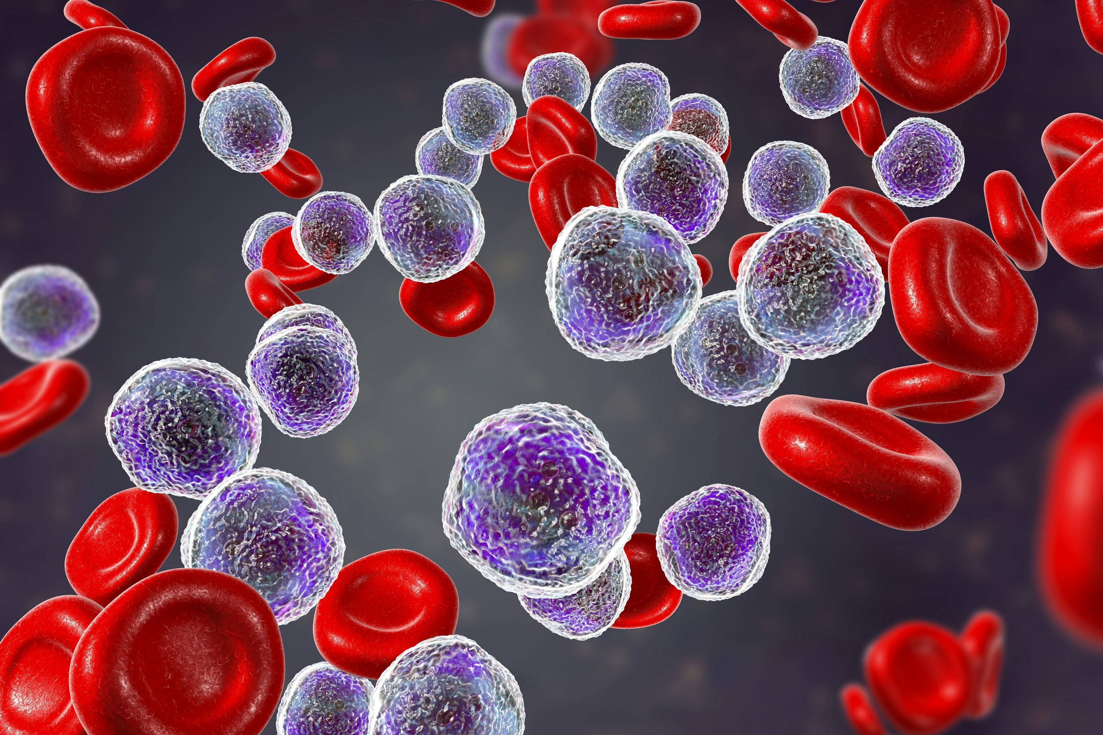 CAR T-Cell Therapy Ushers in New Era for Myeloma Treatment