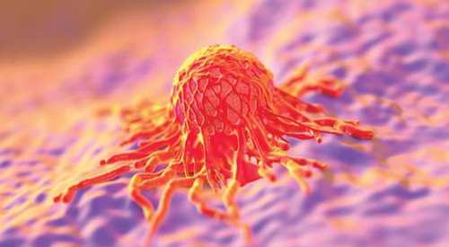 Pembrolizumab Induces Encouraging Outcomes in Advanced Clear Cell Gynecologic Cancer