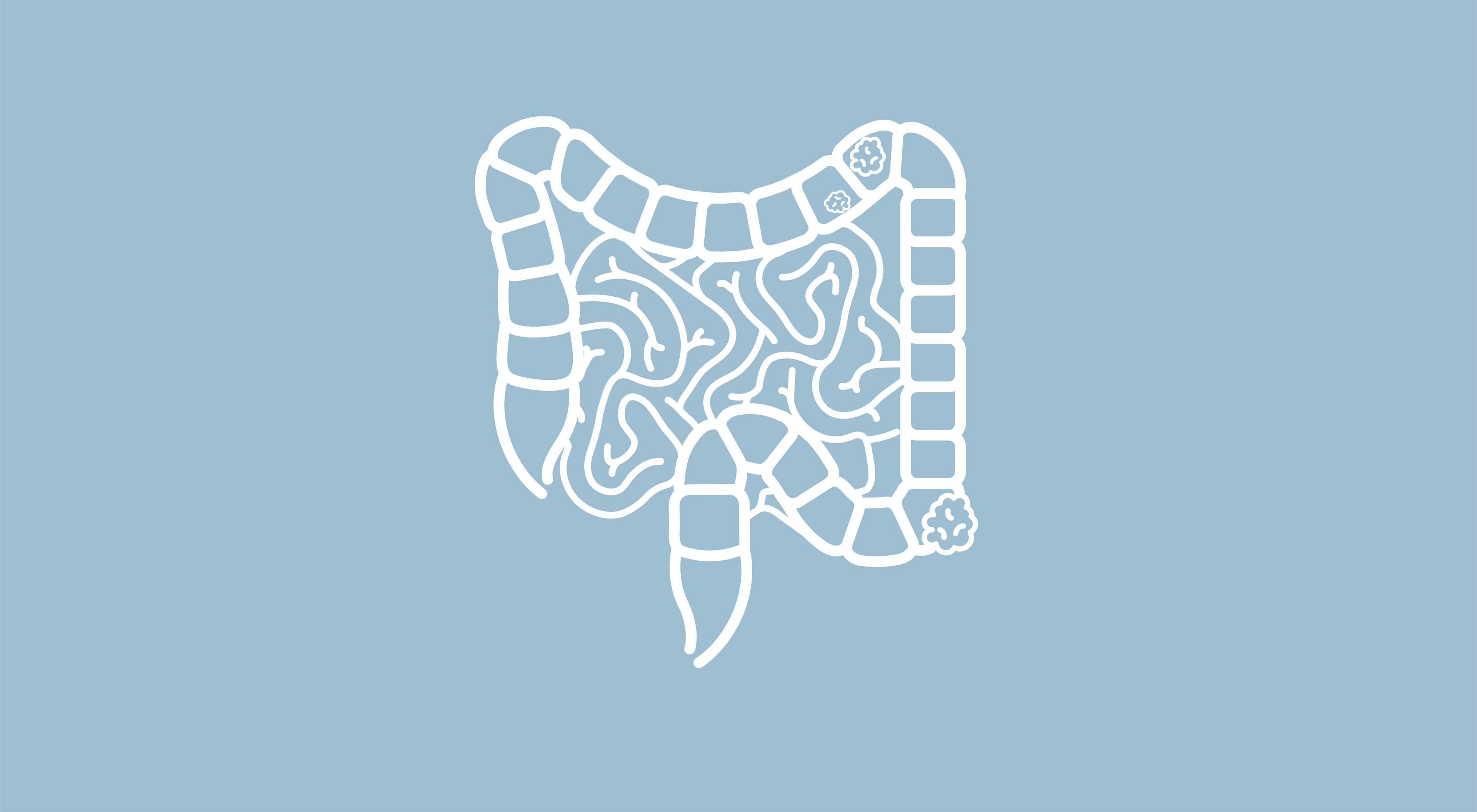 USPSTF Recommends Earlier Screening for Colorectal Cancer
