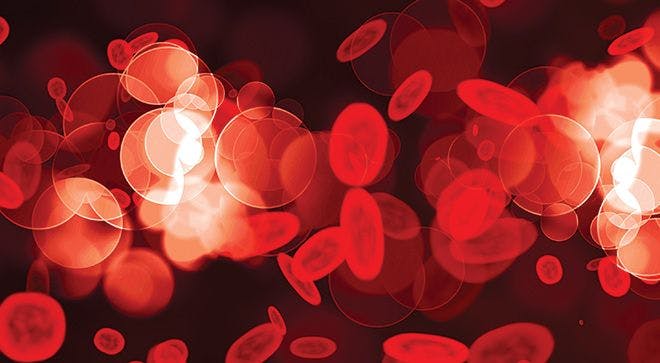 Brentuximab Vedotin Combo Beats Standard Frontline Therapy for Treatment of Advanced HL
