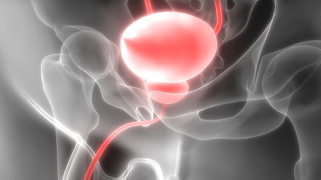 Drug Combination Is Promising in Bladder Cancer Subset