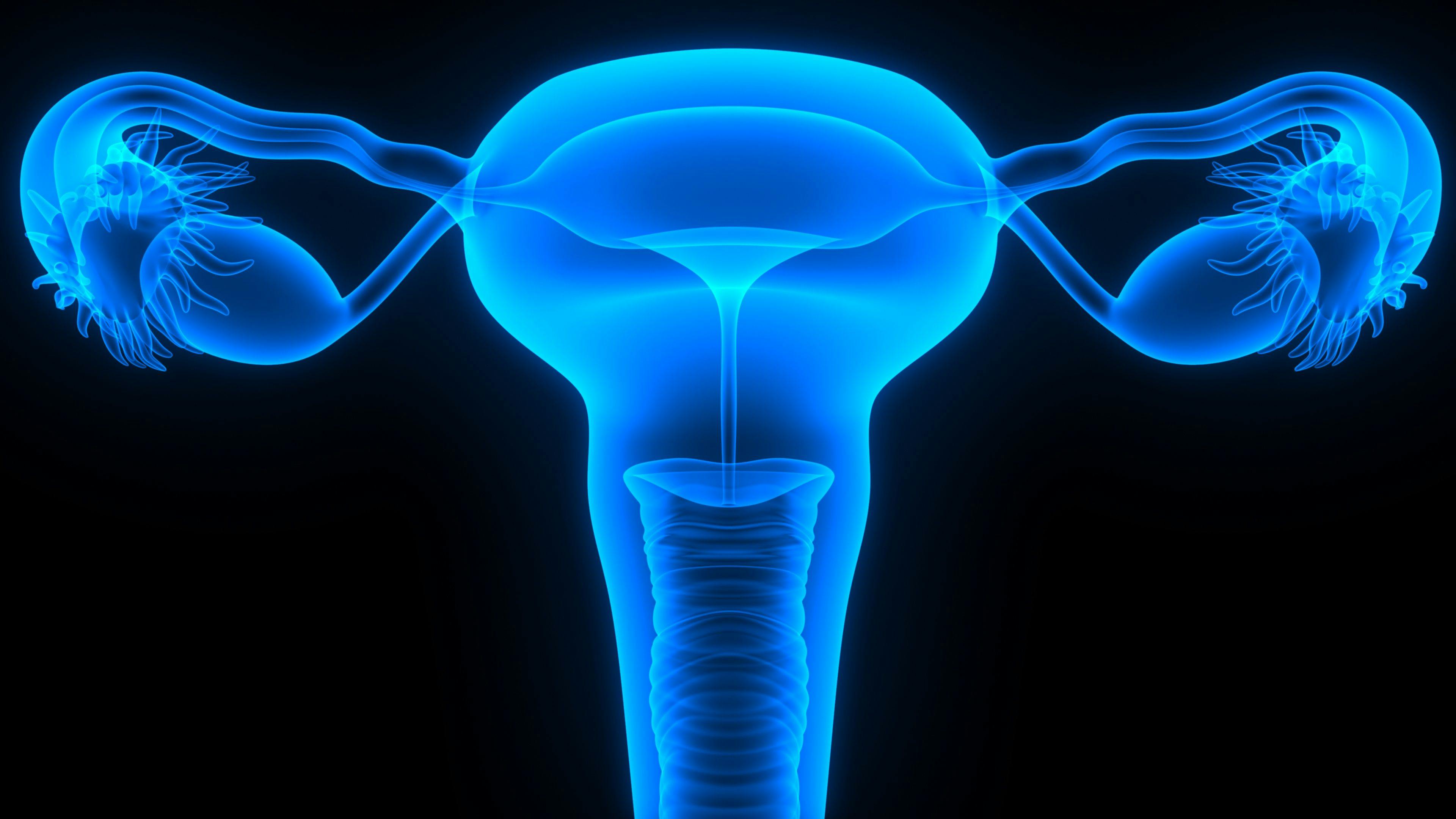 HIPEC Plus Surgery Improves Survival in Stage III Ovarian Cancer