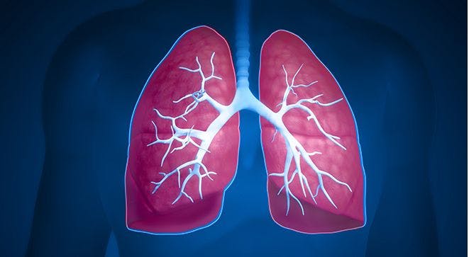 Minorities Not Adequately Represented in Lung Cancer Screening Guidelines