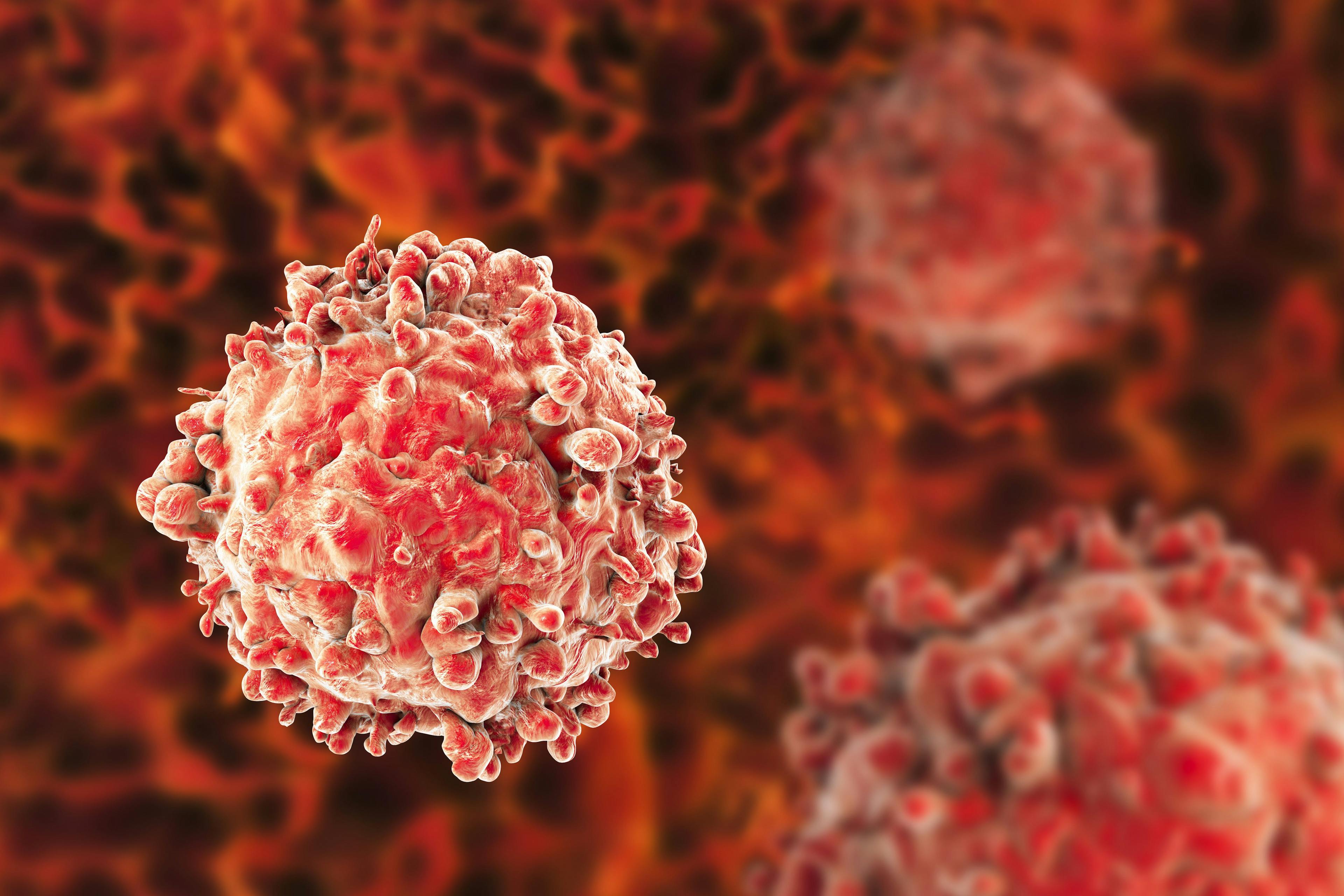 T-Cell Acute Lymphoblastic Leukemia