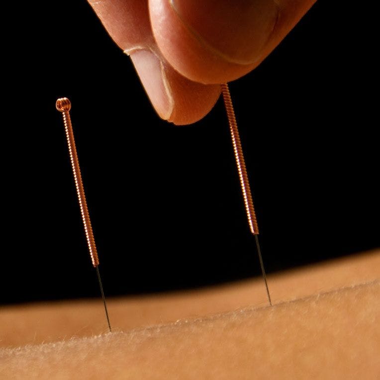 Short-term group acupuncture is valuable and cost-effective for patients with breast cancer, though it may not be the first form of therapy that comes to mind when trying to manage cancer pain.