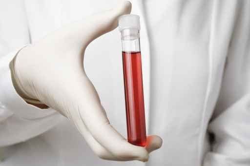 Updated IASLC Report Calls Liquid Biopsy Preferred Method of Molecular Testing