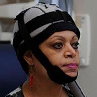 Scalp Cooling to Ease Chemotherapy-Induced Hair Loss Gets High Marks in Randomized Trial