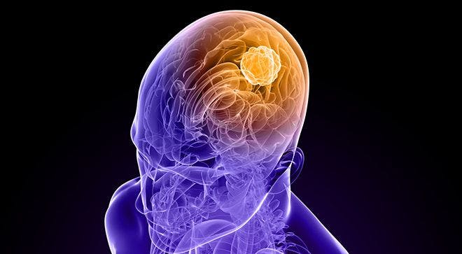 Berubicin Breaches Blood-Brain Barrier to Attack Brain Tumors