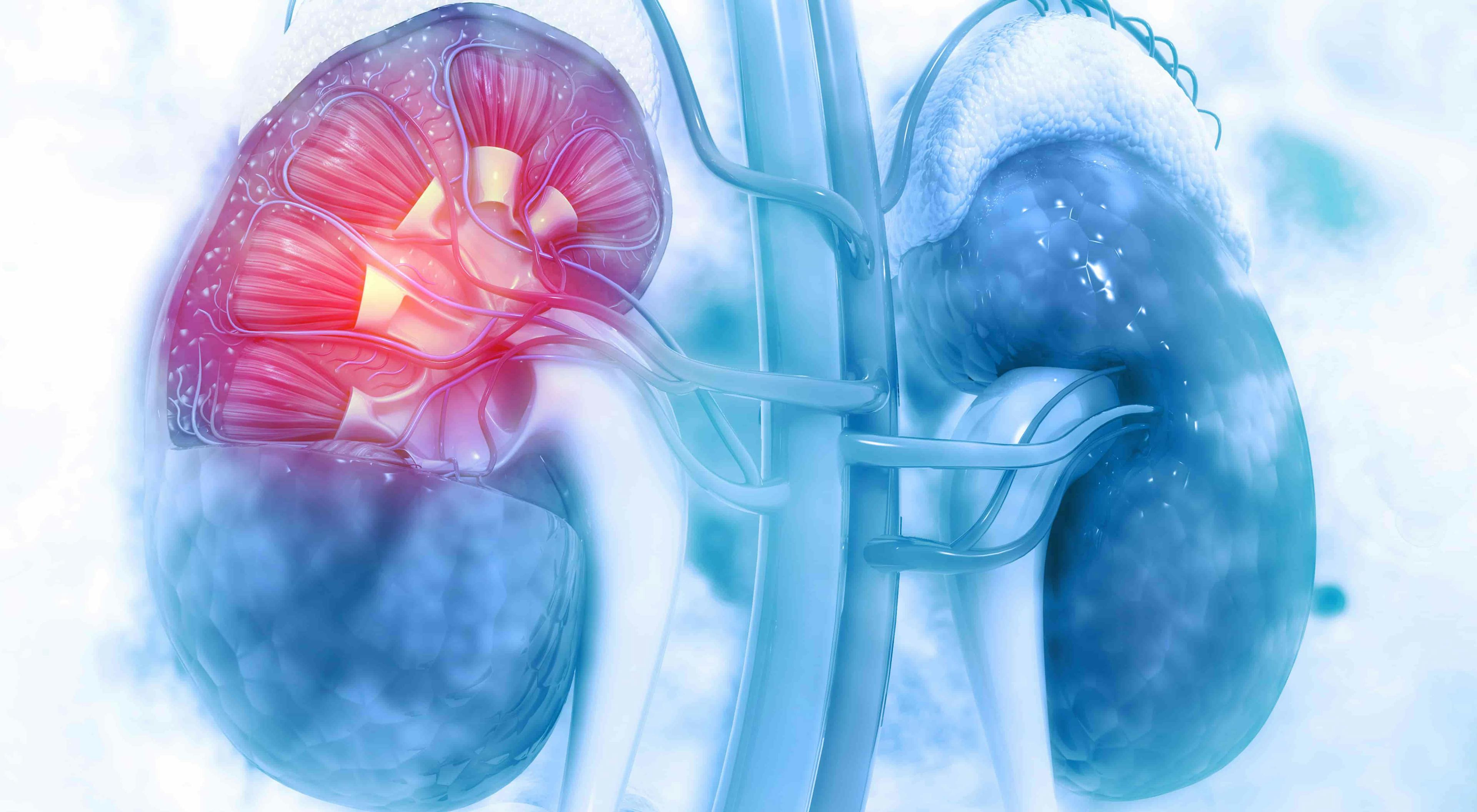 Lenvatinib/Pembrolizumab Boosts Outcomes For Next Line Therapy in Advanced Renal Cell Carcinoma