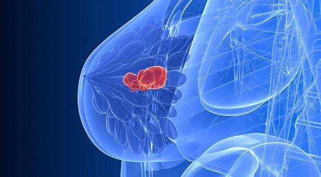 Advances in HER2+ Breast Cancer
