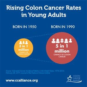 Rising Colon Cancer Rates in Young Adults