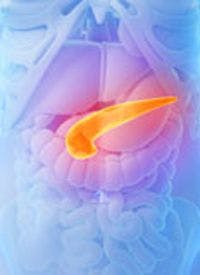 Recent-Onset Diabetes Linked to Poorer Survival in Pancreatic Cancer