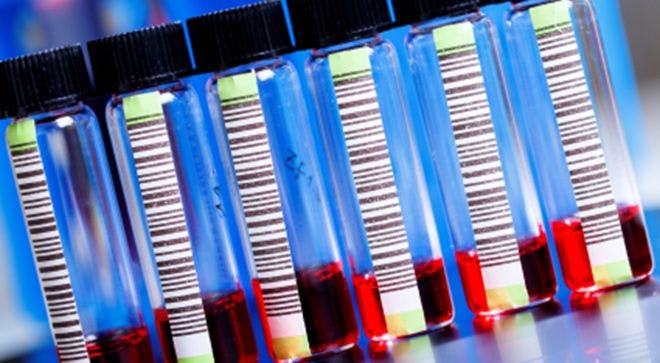 Blood-Based Liquid Biopsy for Detecting Colorectal Cancers Has High Degree of Accuracy