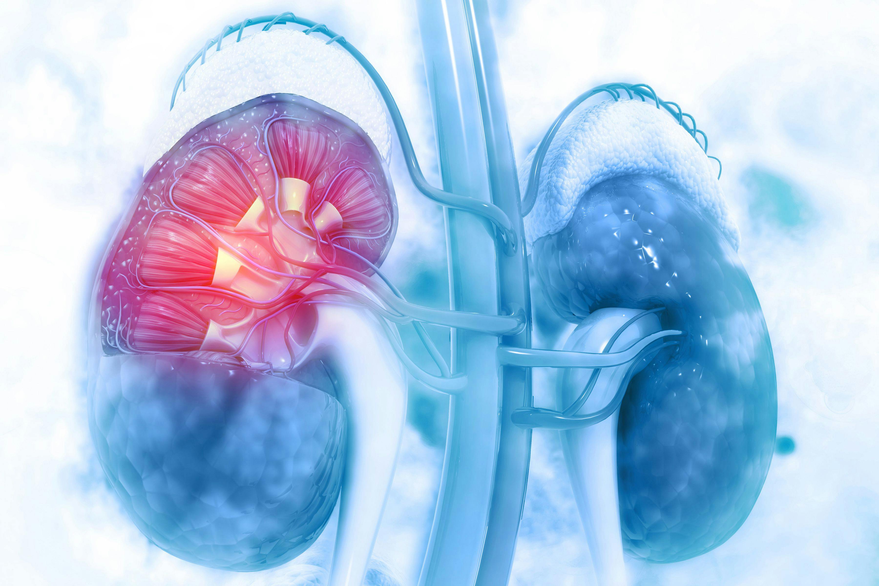 Cabozantinib Associated With Higher Rates of Certain AEs in Advanced Kidney Cancer