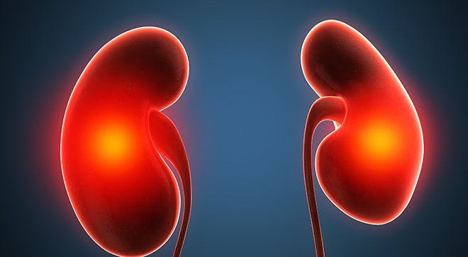 Kidney Removal May Be Unnecessary with Sunitinib Therapy in Metastatic Kidney Cancer