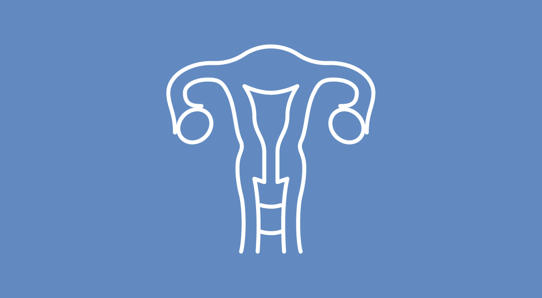 ADC Gets FDA Fast Track Designation for Platinum-Resistant Recurrent Ovarian Cancer