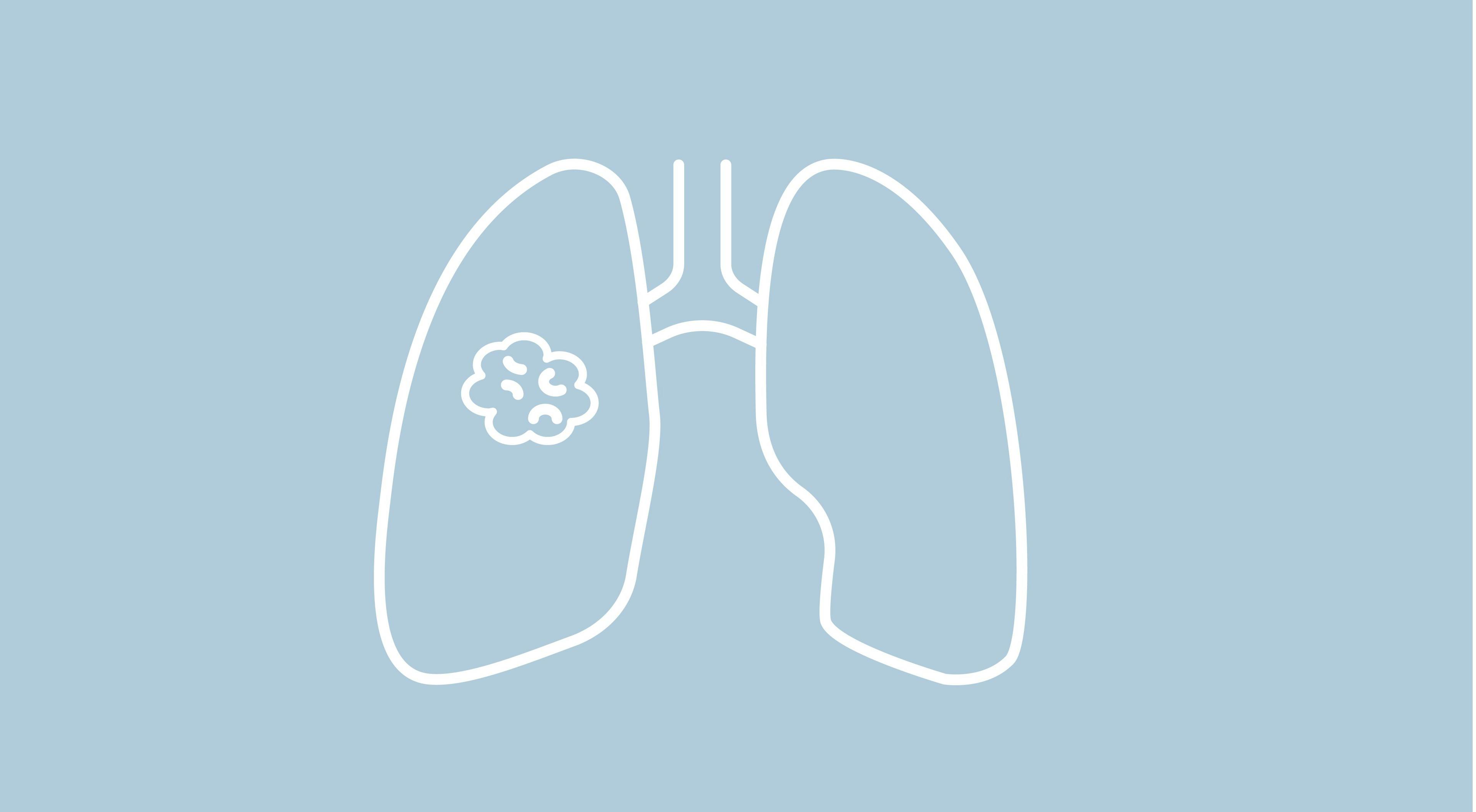 Updates in Lung Cancer Screening Criteria Increase African American Patient Participation 
