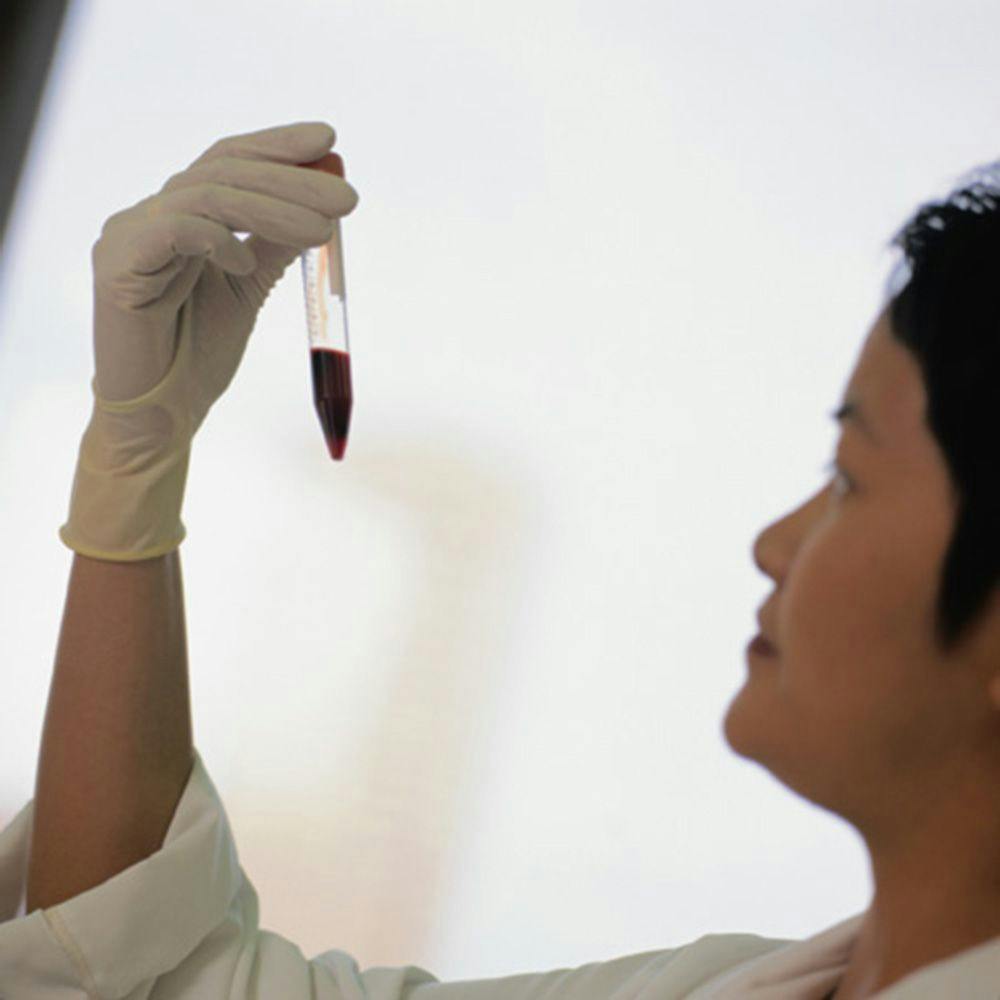 A Blood Test May Be Able to Detect Ovarian Cancer