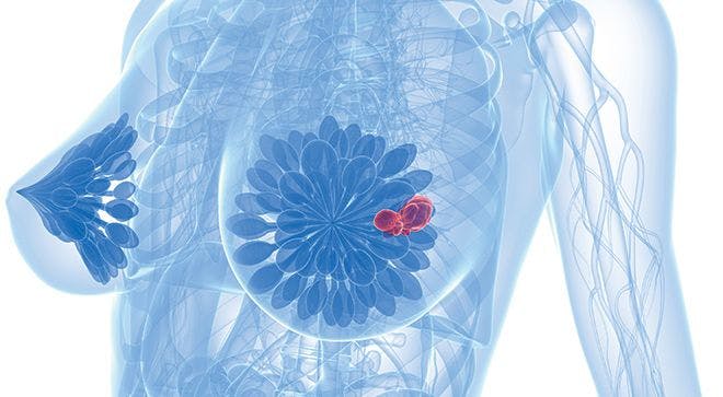 Eribulin Elicits Promising 2-Year Overall Survival in Pretreated Metastatic Breast Cancer