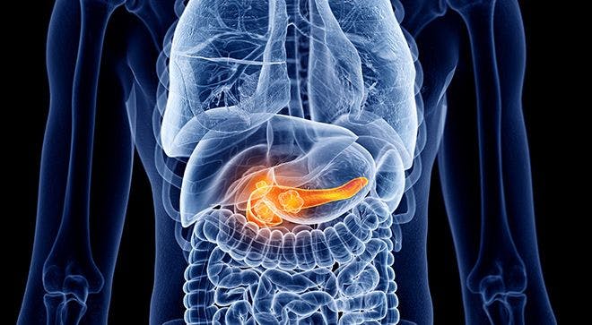 Pancreatic Cancer Risk Among People Newly Diagnosed with Diabetes