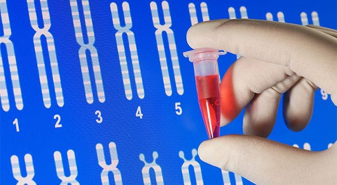Genetic Test Aims to Prevent Over-Treatment, Lower Care Costs in Bladder Cancer
