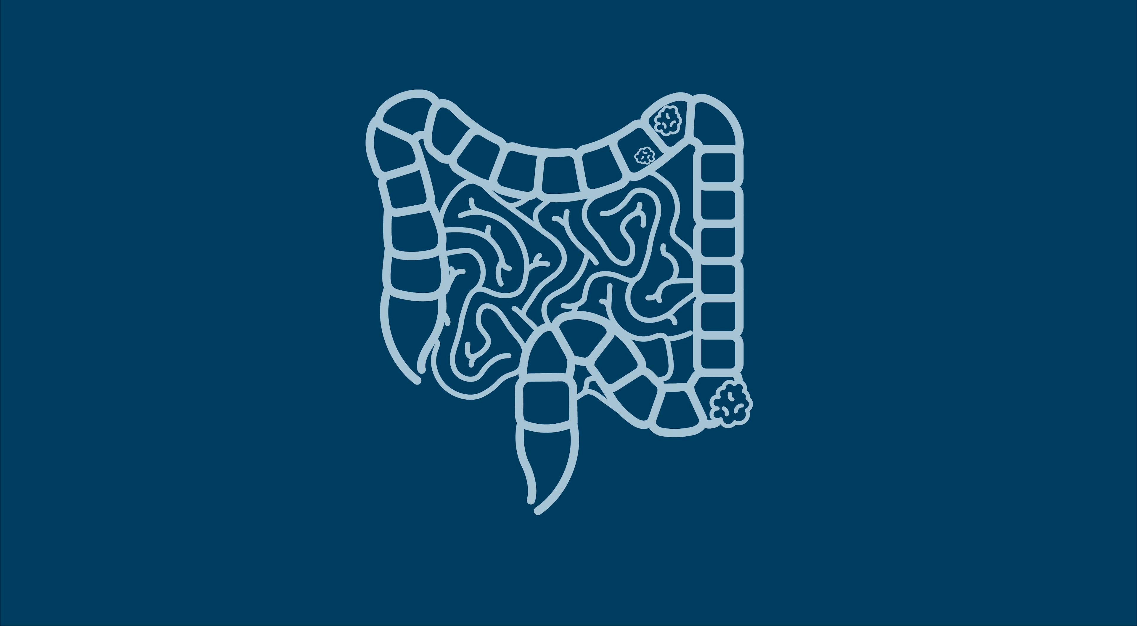 Endoscopies for Women 50 Years or Younger Reduce Colorectal Cancer Risk