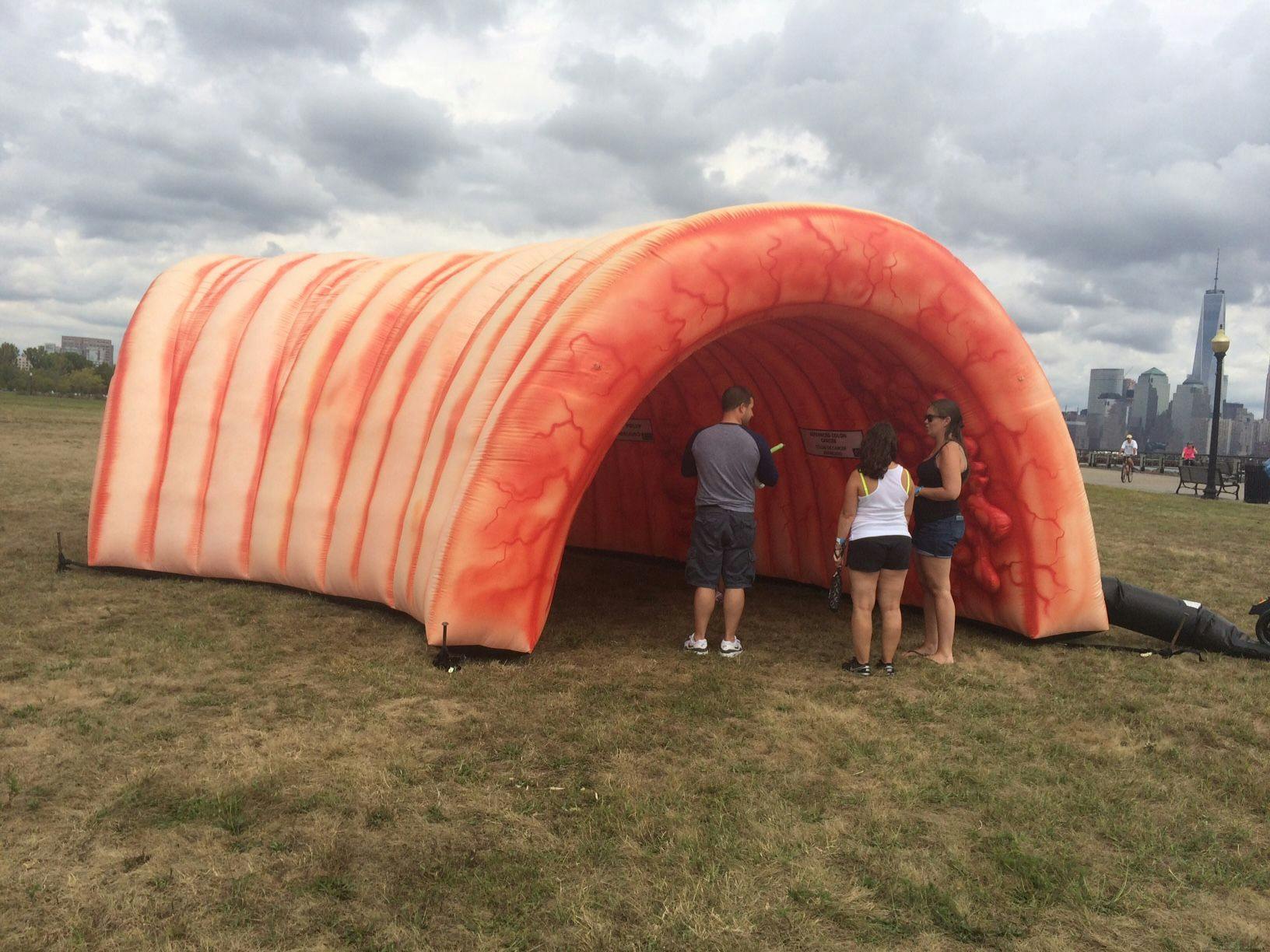 Inflatable Colon