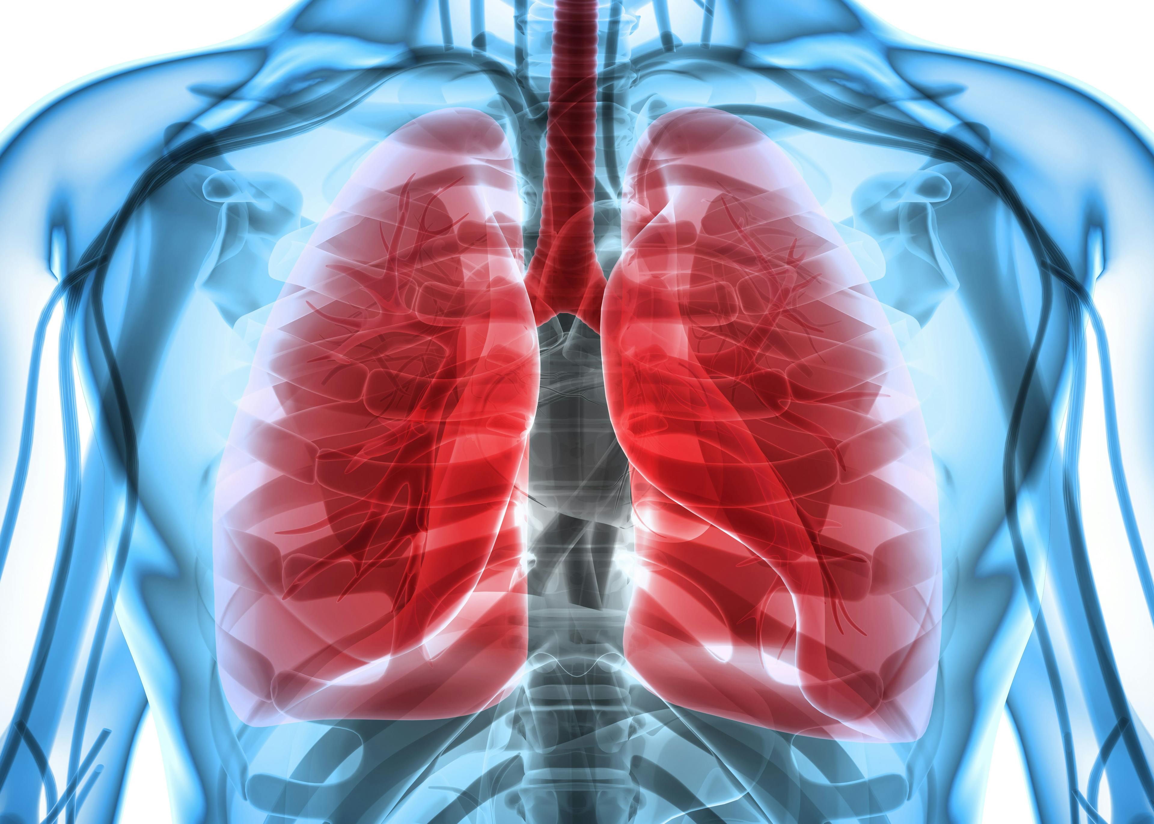 Sotorasib Produces Durable Clinical Benefit in Treatment of KRAS p.G12C + NSCLC 