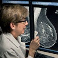 3D Mammograms Improve Breast Cancer Detection, Reduce Callbacks