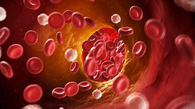At-Home Blood Thinner Use During Systemic Therapy May Decrease Risk for Clots