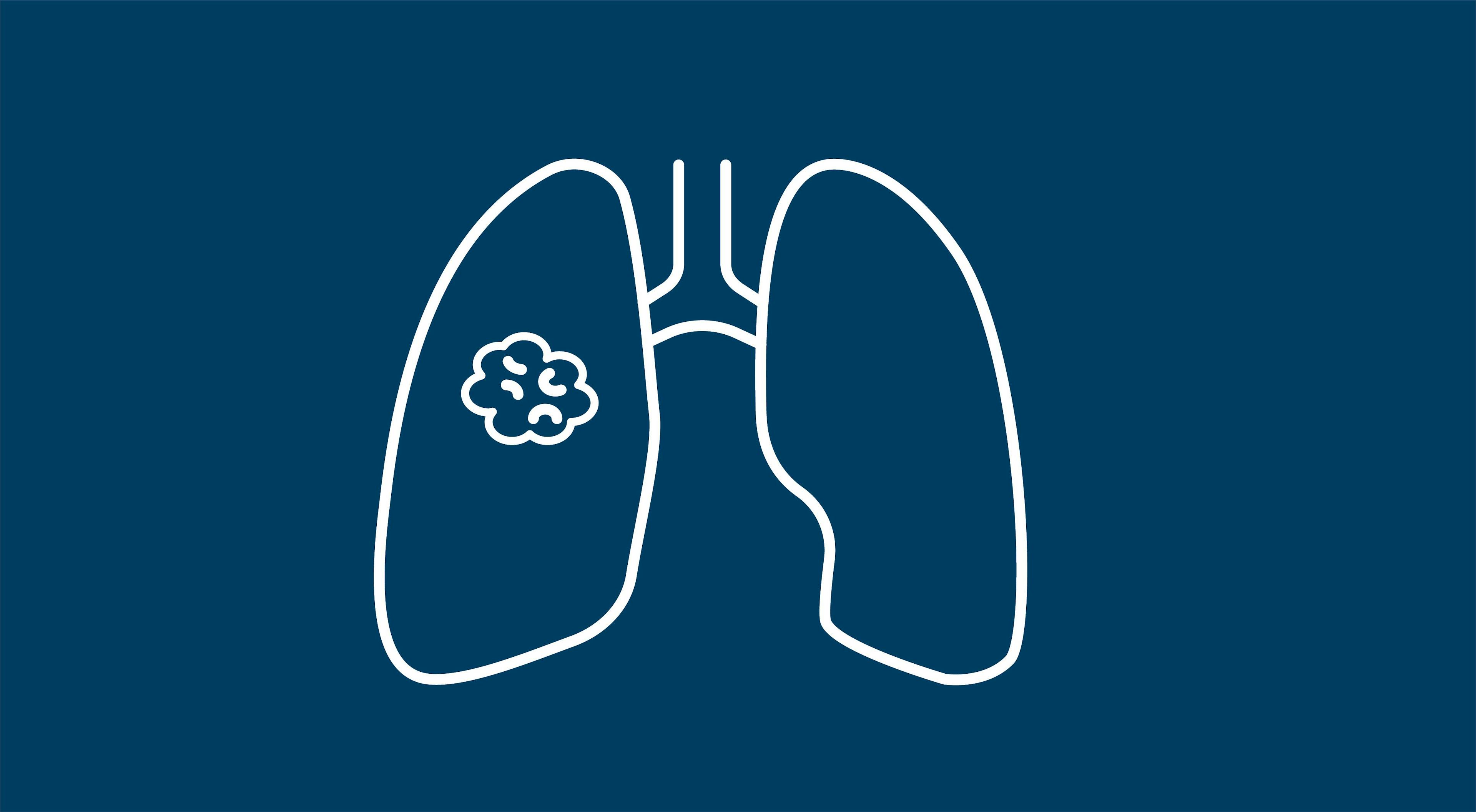 Poziotinib Linked With Promising Response Rates in HER2 Exon 20 Insertion-Mutated NSCLC