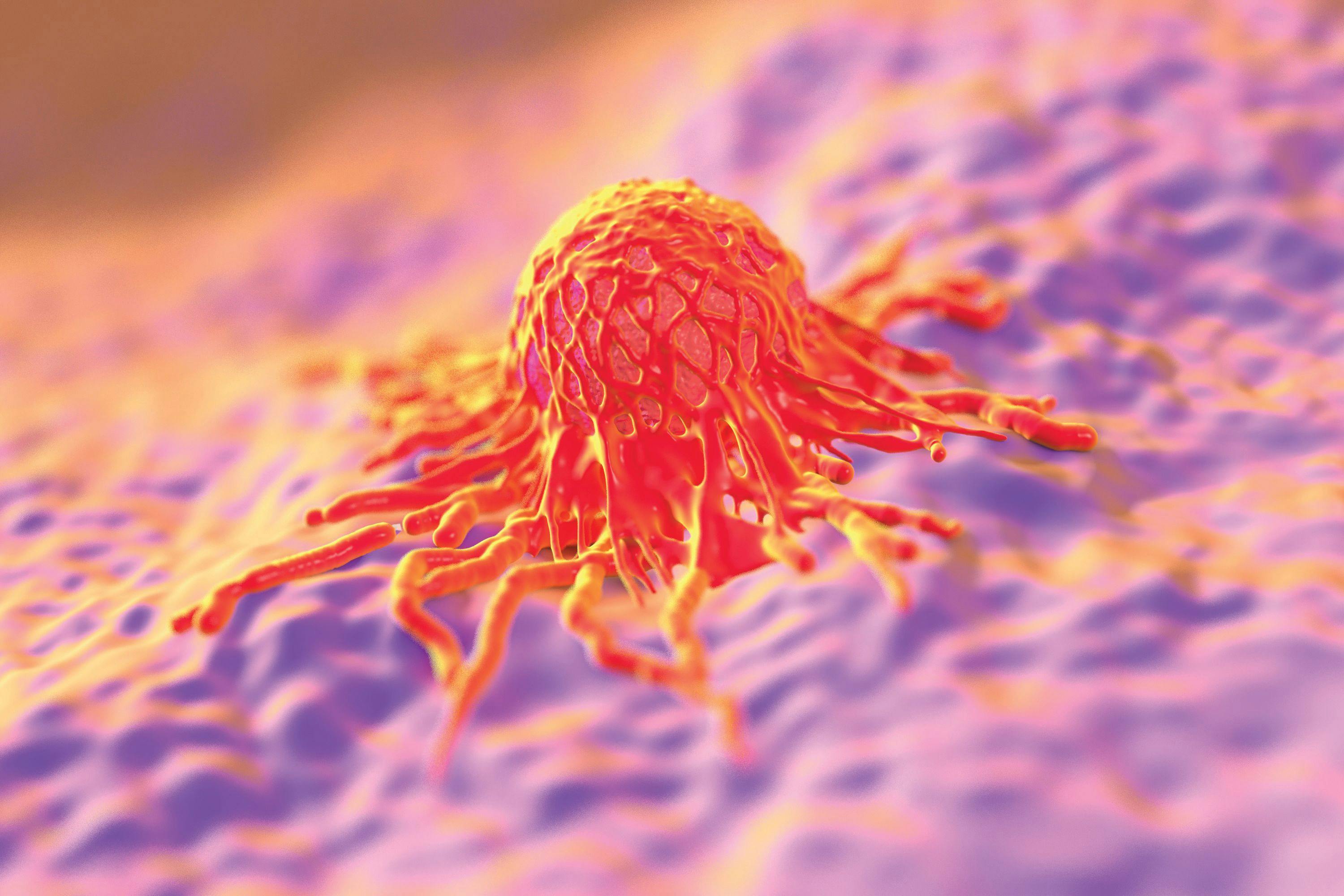 Gynecologic Cancer Cell